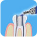 endodonti